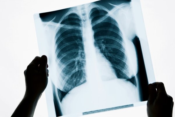 Кракен это что за магазин